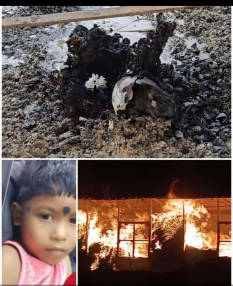 आगजनी की बड़ी घटना : गर्ल्स पोटाकेबिन में लगी आग...एक मासूम की मौत, 305 बच्चियों का रेस्क्यू