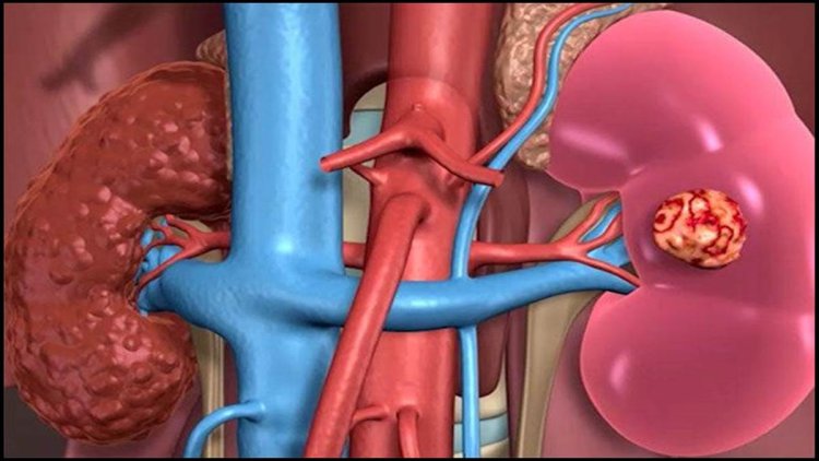 kidney को रखना चाहते हैं स्वस्थ? इन 5 गलतियों से बचें वरना हो सकता है नुकसान