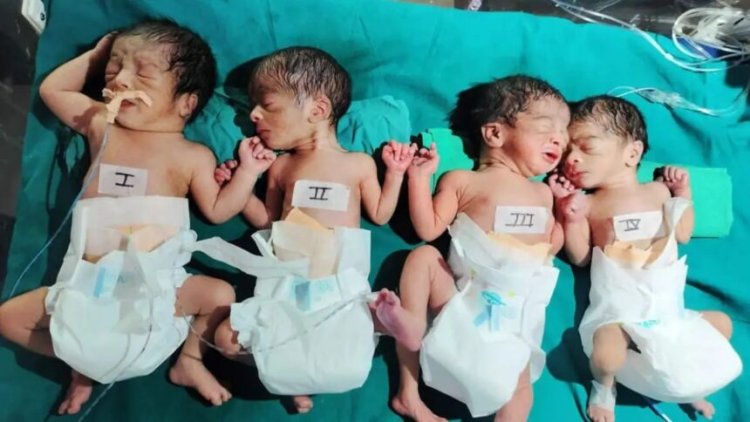 CG : महिला ने एक साथ तीन लड़की और एक लड़के को दिया जन्म, खूब हो रही चर्चा